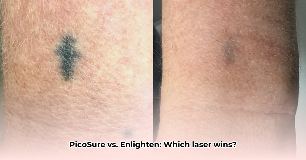 laser-tattoo-removal-in-cincinnati-ohio